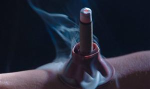 綠色醫(yī)療市場(chǎng)需求空間大 2021艾灸行業(yè)投資潛力調(diào)研