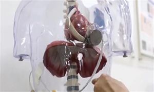 他沒有心跳卻能像正常人一樣生活沖上熱搜 人工心臟行業(yè)發(fā)展情況如何
