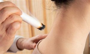 2023艾灸條行業(yè)供需市場(chǎng)調(diào)研及未來前景分析
